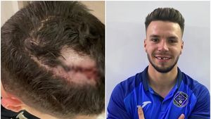 Academica Clinceni, etapa și victima! Octavian Vâlceanu și Andrei Cordea, accidentări horror în ultimele două meciuri: „Din ce știu eu, se sancționează cu cartonaș roșu!” | EXCLUSIV