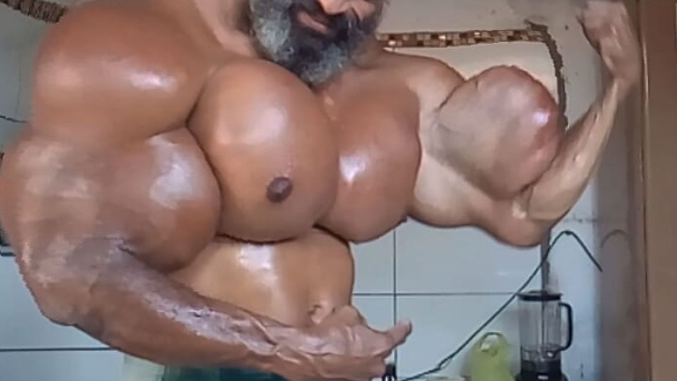 Și-a injectat ulei în corp pentru a arăta ca Arnold Schwarzenegger, iar acum riscă să-i fie amputate membrele! E șocant cum poate arăta acest culturist VIDEO și FOTO