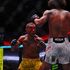 De nerecunoscut! Așa arată starul UFC după ce a ajuns în spital pentru că a fost făcut K.O.