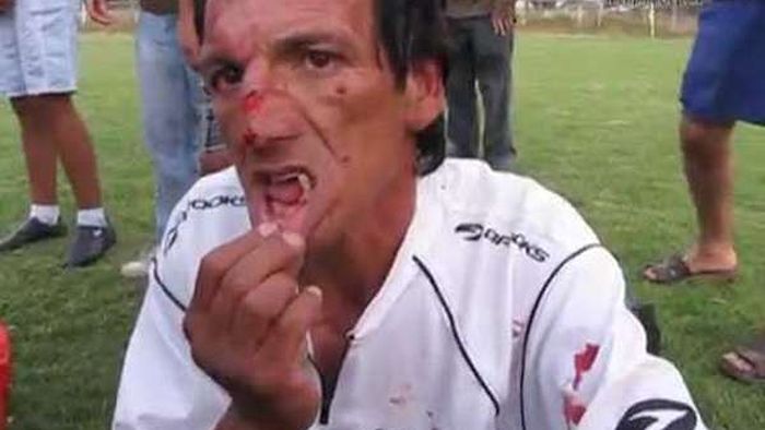 VIDEO Clipe de coșmar pentru o brigadă de arbitri!** Un asistent și-a pierdut mai mulți dinți în urma loviturilor aplicate de suporteri