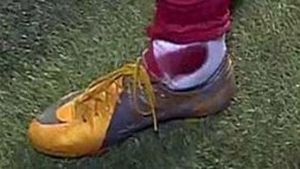 Croații l-au RUPT pe Ronaldo! A terminat meciul de la Zagreb sângerând și huiduit!** Motivul? "Sunt frumos, bogat și bun!"