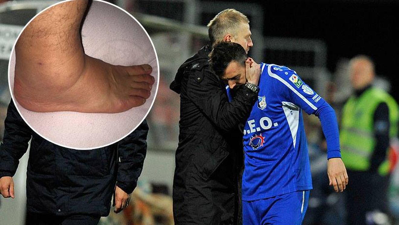 FOTO | Glezna lui Hora arată horror la patru zile după intervenția lui Stăncioiu. "Ne e frică să nu aibă ligamentele afectate"
