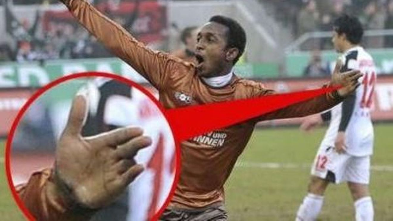 FOTO ȘOCANT** Și-a pierdut un deget în timpul unui antrenament