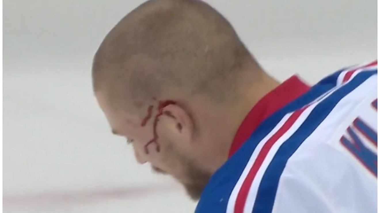 "This is hockey": 13 copci pentru ca medicii să îi coasă o parte a urechii la loc. A revenit pe gheață și a dat golul victoriei