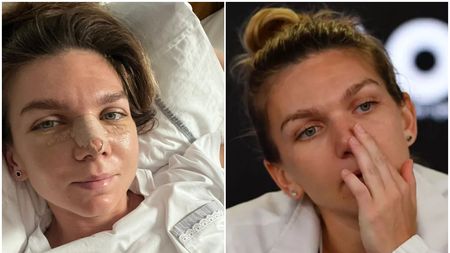 Simona Halep a ajuns în cel mai cunoscut tabloid din SUA după ce și-a operat nasul: „Va arăta diferit pe terenul de tenis!" Ce au remarcat americanii la româncă