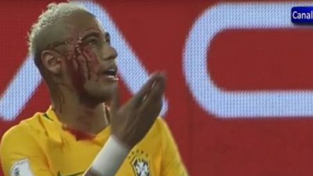 VIDEO | Neymar a încercat să-i treacă mingea printre picioare unui adversar și s-a ales cu arcada spartă