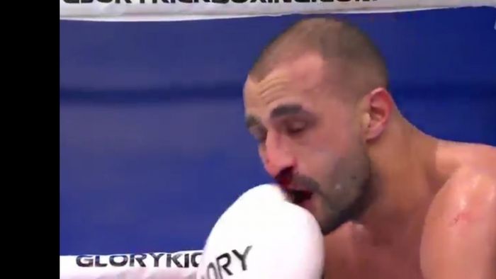 Doamne, Dumnezeule! Badr Hari, umplut de sânge de Benny Adegbuyi! L-a făcut K.O: cum arăta marocanul după ce a fost lovit de român cu bestialitate! FOTO
