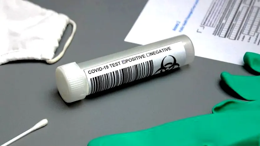 415 cazuri de COVID-19 în ultimele 24 de ore în România