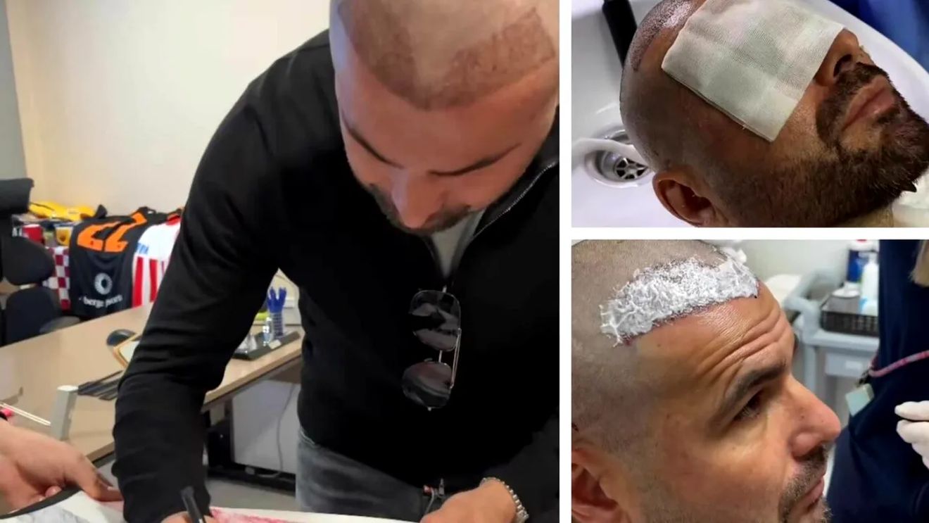 „Nu vă vine să credeți cum arată. E de nerecunoscut”. Adrian Mutu i-a șocat pe englezi cu noul său look, după ce și-a făcut implantul de păr