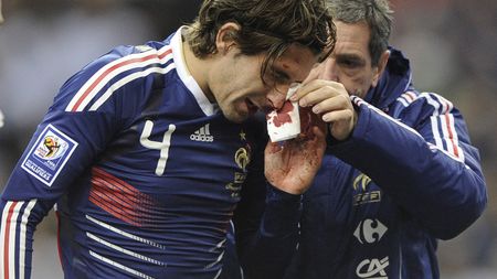 Escude s-a accidentat** și va rata meciul cu Unirea, din Ligă!