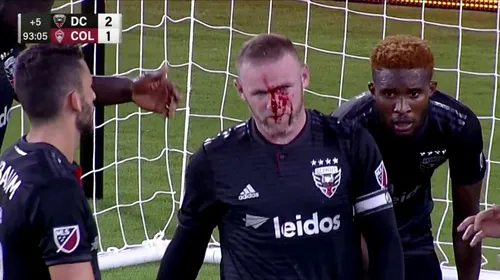 Wayne Rooney, plin de sânge! Ce a pățit atacantul | VIDEO