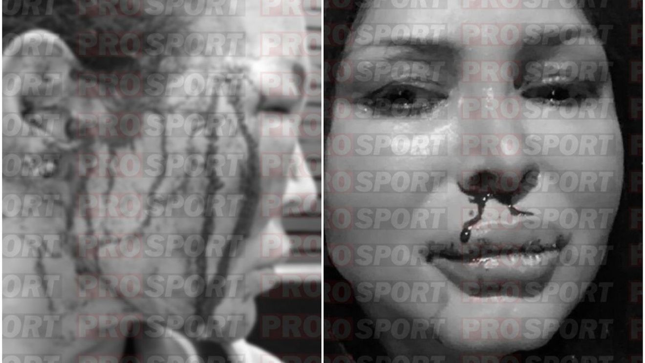 Dinamo și Federația de Baschet au angajat pe mii de euro un antrenor grec acuzat la Atena de fosta sa prietenă de vătămare corporală gravă, furt și consum de droguri! Femeia a relatat cum a fost strangulată, înjunghiată și a avortat din cauza bătăilor primite. Manolis Papamakarios a venit în România pe filiera Vlad Moldoveanu - Carmen Tocală | SPECIAL