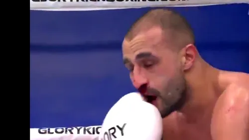 Doamne, Dumnezeule! Badr Hari, umplut de sânge de Benny Adegbuyi! L-a făcut K.O: cum arăta marocanul după ce a fost lovit de român cu bestialitate! FOTO