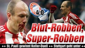 FOTO** Robben a vărsat sânge pentru "dubla" cu Hoffenheim! Bayern căștigă cu 4-0