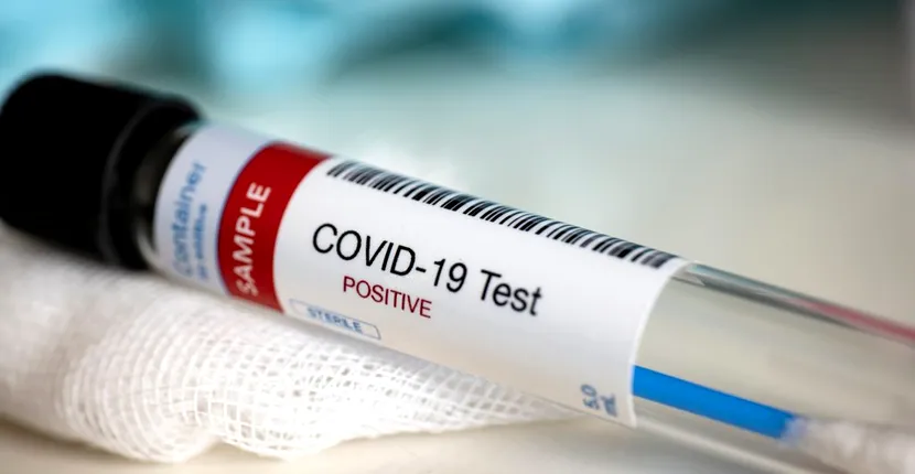 Când vor ajunge primele teste rapide pentru Covid-19 în spitale. Ministrul Sănătății vine cu vești bune