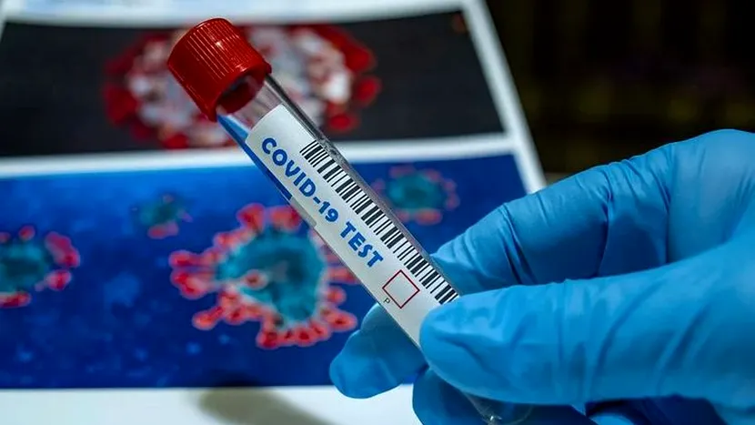 9.685 de noi îmbolnăviri cu coronavirus în România în ultima zi