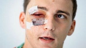 Așa arată Ljubicic după ce l-a cunoscut pe "Mad Dog" Pulhac! Croații le promit "iadul" dinamoviștilor, la Split!