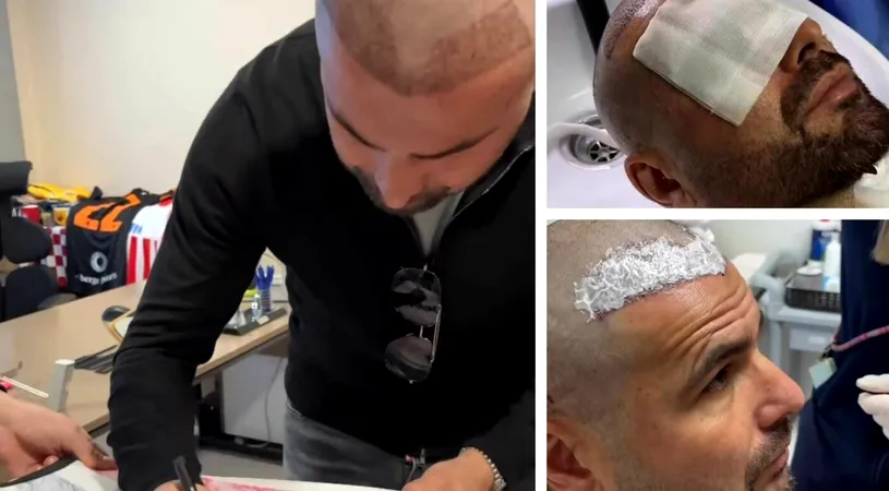 Adrian Mutu și-a făcut implant de păr. Reacția fabuloasă a „Briliantului” când a explicat de ce a apelat la această procedură