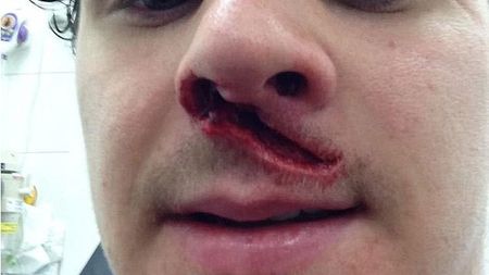 FOTO Imagini de groază care îți taie respirația!** A rămas șocat când s-a văzut în oglindă! Cum a ajuns în această stare