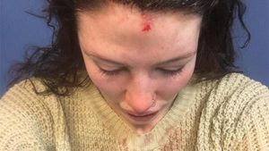 FOTO INCREDIBIL | Un jucător de cricket și-a desfigurat iubita cu bătaia