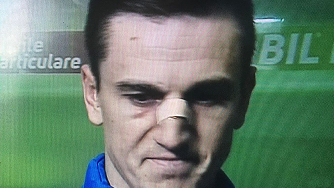 EXCLUSIV | Cum se simte Florin Gardoș după cotul încasat în față în meciul cu Dinamo și reacția asistentei care l-a consultat. "Mă doare în continuare"