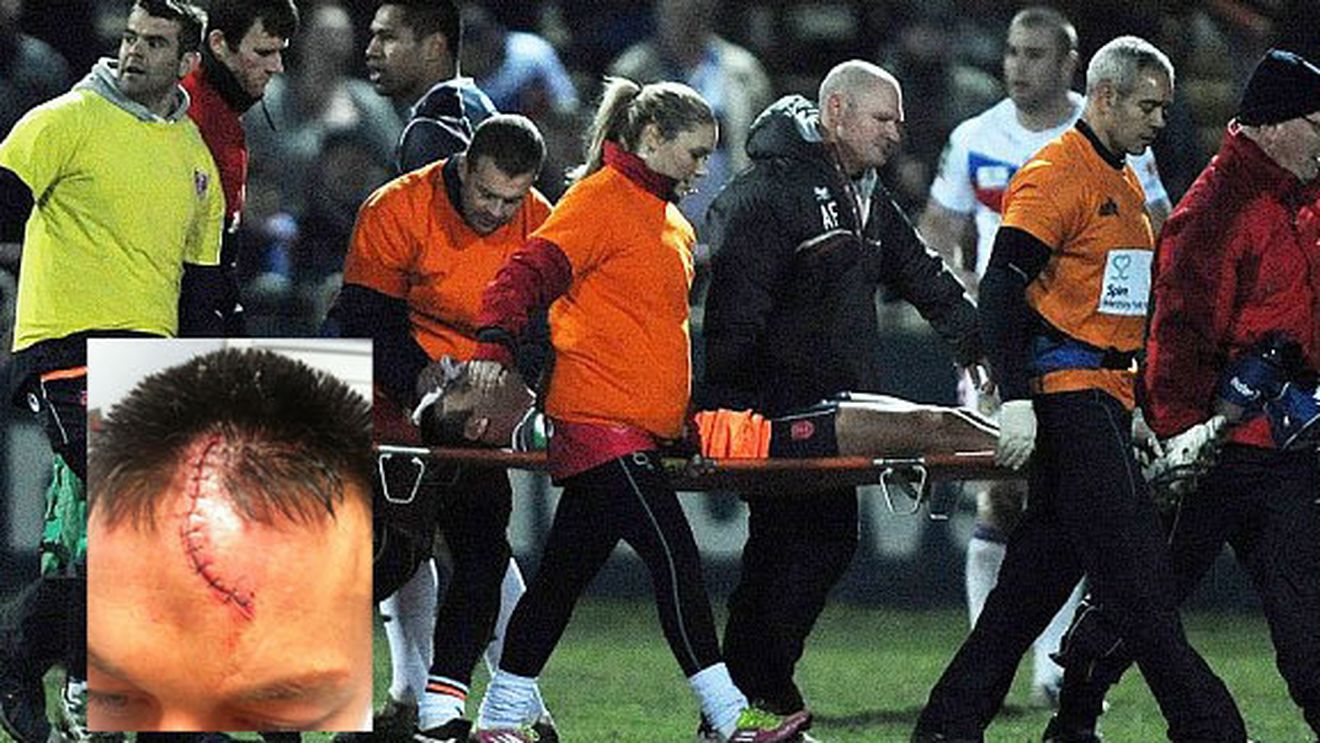 "E doar o zgârietură! Oricum voiam să-mi schimb look-ul"** Accidentare șocantă în Anglia! FOTO Cum arăta înainte și după: