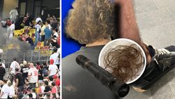 Mărturia cutremurătoare, în imagini și cuvinte, a familiei lovite cu torța la Dinamo – Farul: „Mama are arsuri și dureri la sân, eu am rămas fără păr și haine”. EXCLUSIV