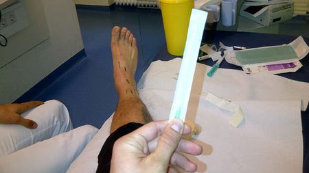 FOTO Cu Marica la infiltrații!** "Tricolorul" a postat poze din timpul tratamentului