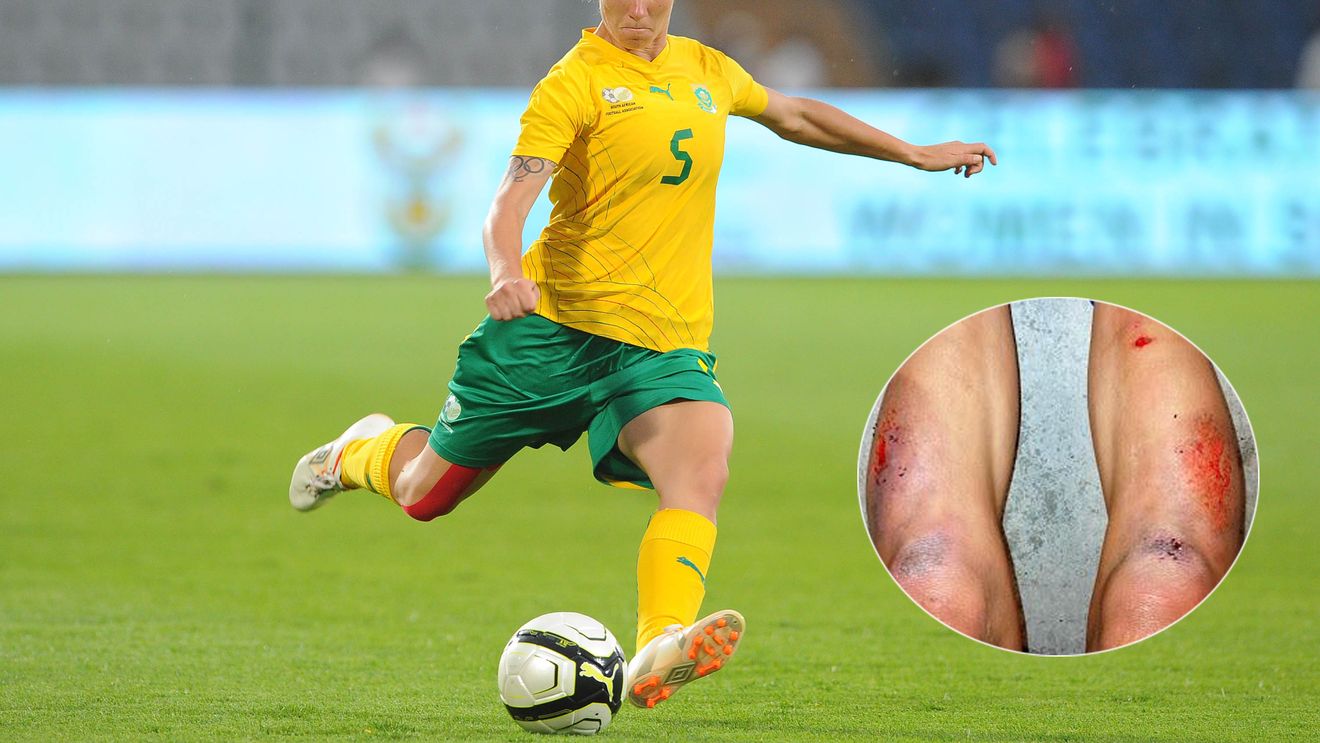 FOTO | Sinteticul face victime! Revoltă înaintea Mondialului feminin din Canada: "Uite ce se întâmplă când joci aici. Pe bărbați nu i-ar lăsa niciodată să facă asta"