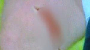 Moment șocant pe Old Trafford! FOTO** Nu te uita dacă nu ești tare de inimă! Coapsa lui Wayne Rooney a fost crestată de un adversar