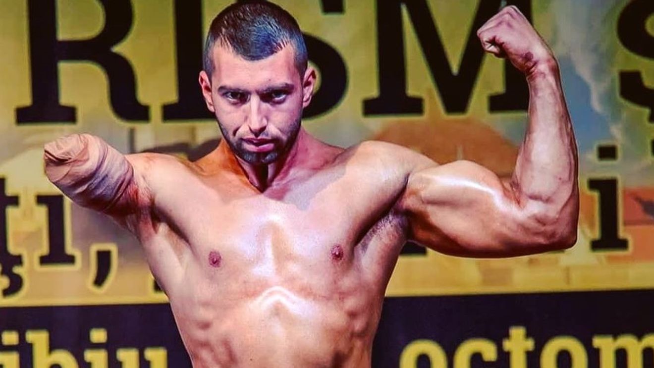 Lecție de viață! O „sărăriță” i-a smuls brațul, iar în culturism a găsit puterea de a nu renunța. FOTO ȘI VIDEO IMPRESIONANTE