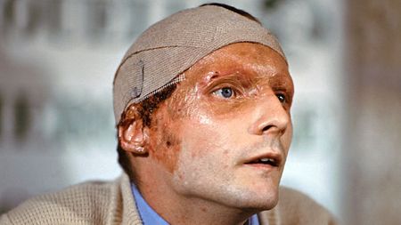 SPECIAL | "Șobolanul", viața cu cicatrici și șepcile. „În toți acești ani am văzut oameni care au murit în fața mea". Mărturisirea lui Niki Lauda, la 40 de ani de la evenimentul care l-a lăsat desfigurat 