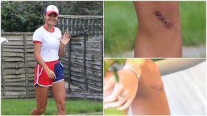 Cum arată piciorul Emmei Răducanu, la două săptămâni după finala US Open! Sportiva a rămas cu o cicatrice urâtă | FOTO