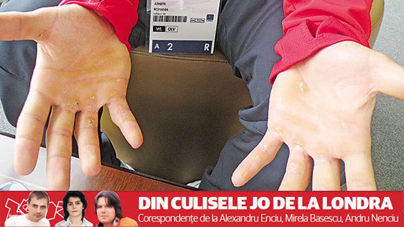 Prețul plătit de Răzvan Martin,** medaliatul cu BRONZ al României la JO: "Mi se rupe carnea de pe mâini"