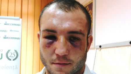 Prețul succesului. OCHII unui campion! Mihai Nistor: "Sper să-mi treacă problemele, pentru a putea boxa la Mondiale. Mai vreau un trofeu anul acesta"