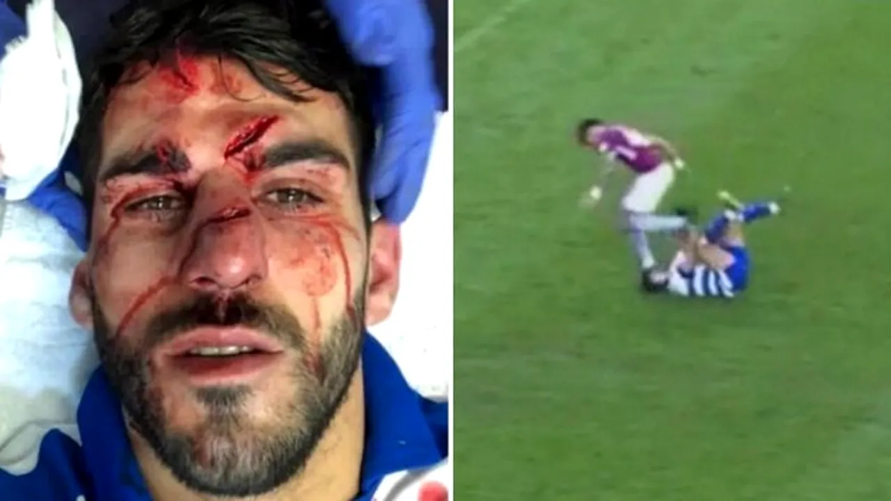 Jucătorul care l-a cotonogit pe Zlatan recidivează! Cum arată fața atacantului de la Reading după intervenția criminală: 