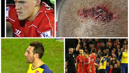 FOTO și VIDEO | Un meci cu de toate. Arsenal - Liverpool a avut accidentări horror, un fotbalist eliminat și multe glume la final. Ce au inventat fanii despre Borini și Cazorla