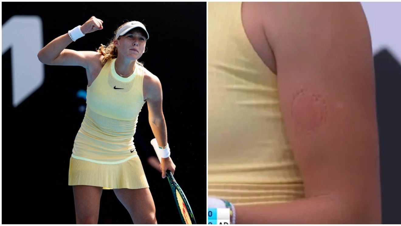 Gesturi șocante ale puștoaicei de 16 ani care face furori la Australian Open: s-a mușcat singură, în timpul meciului. FOTO