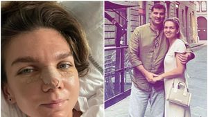 Simona Halep a spus tot adevărul! De ce și-a făcut rinoplastie chiar după divorț și motivul pentru care și-a modificat forma nasului: „Nu-mi plăcea deloc!" FOTO