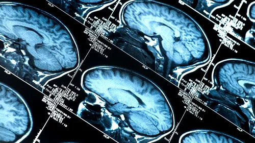 Descoperire șocantă pe creierul unui jucător decedat la 27 de ani. Afecțiunea gravă care riscă să compromită un sport de miliarde de dolari