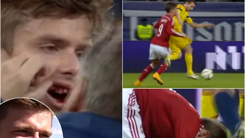 Ce ironie! Sânmărtean, pe post de Mureșan. I-a stricat debutul lui Andersen cu un cot puternic în figură. Mijlocașul lui Ajax a umblat noaptea prin București după un dentist: are doi dinți distruși