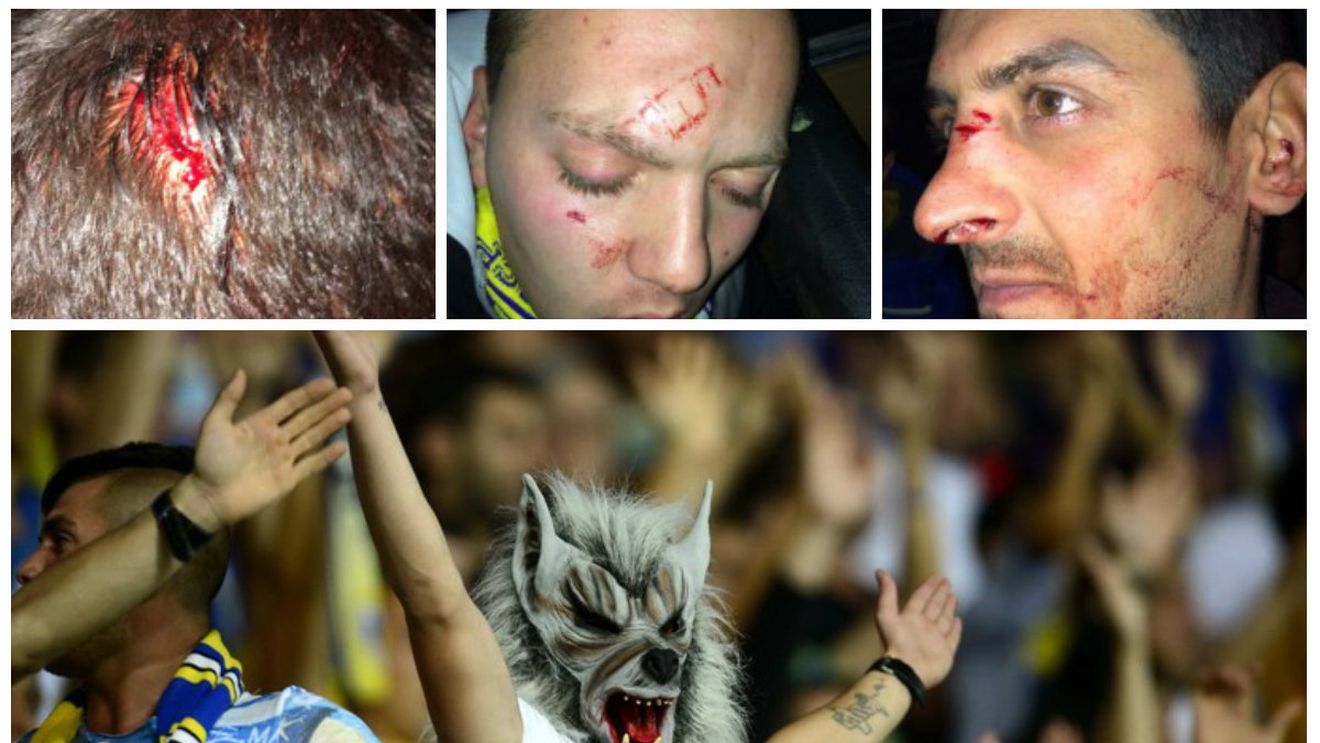 Petrolul, fără galerie la meci! FOTO: Primele imagini după conflictul cu jandarmii. "Au fost bătuți cu bestialitate"