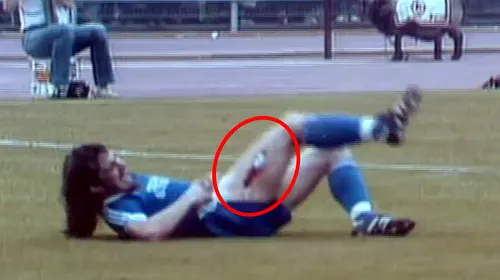 VIDEO: Noul tehnician al Oțelului a suferit una din cele mai urâte accidentări din istoria fotbalului. Imagini șocante