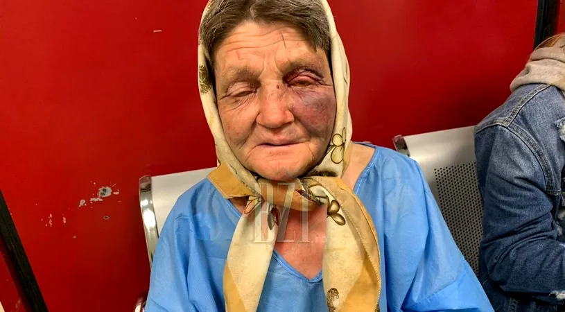 Bătrână, snopită în bătaie de 3 tineri, în gara din Iași. Femeia a ajuns de urgență la spital, cu răni pe tot corpul! 