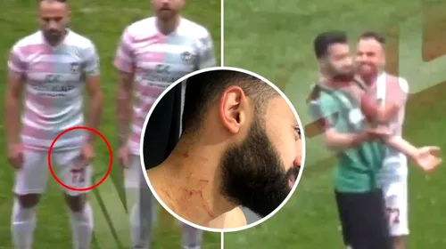 Incidente șocante într-un meci din Turcia! VIDEO | Un jucător a fost tăiat cu lama  în timpul jocului