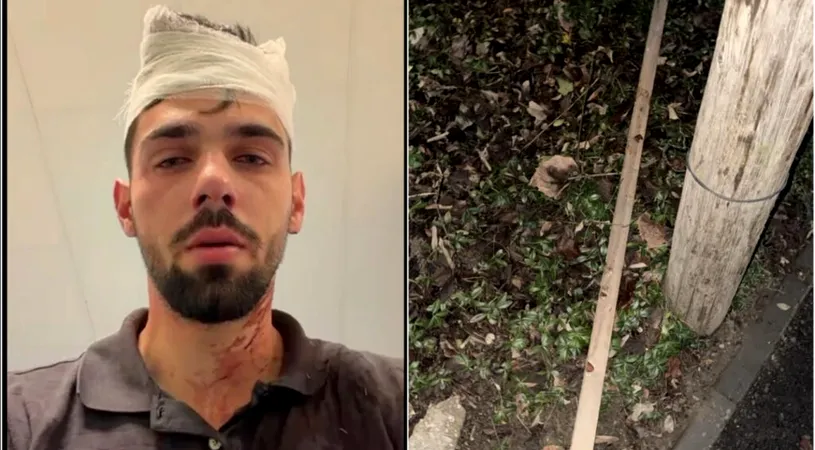 Scene incredibile la Timișoara! Doi fotbaliști care aparțin de Știința Poli, implicați într-o bătaie cruntă aplicată copilului unui fost fotbalist la clubul alb-violet