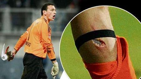 FOTO Accidentare oribilă!** "Piciorul meu arăta ca un iepure pe masa din bucătărie!"