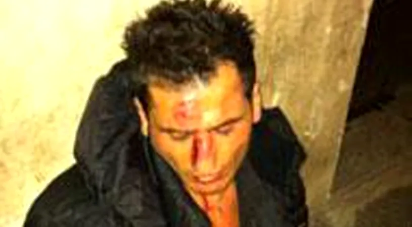 FOTO ȘOCANT** Așa arăta chelnerul din Firenze, imediat după ce a fost bătut de Adrian Mutu