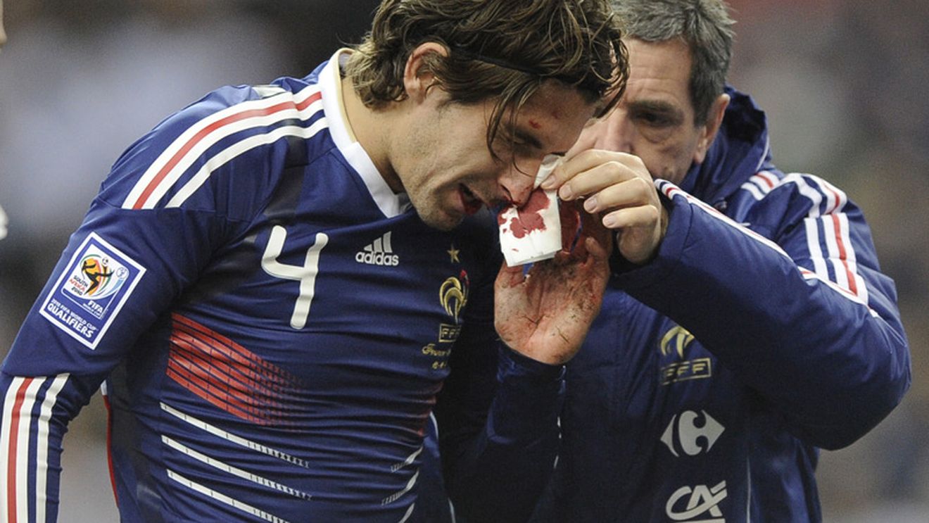 Escude s-a accidentat** și va rata meciul cu Unirea, din Ligă!