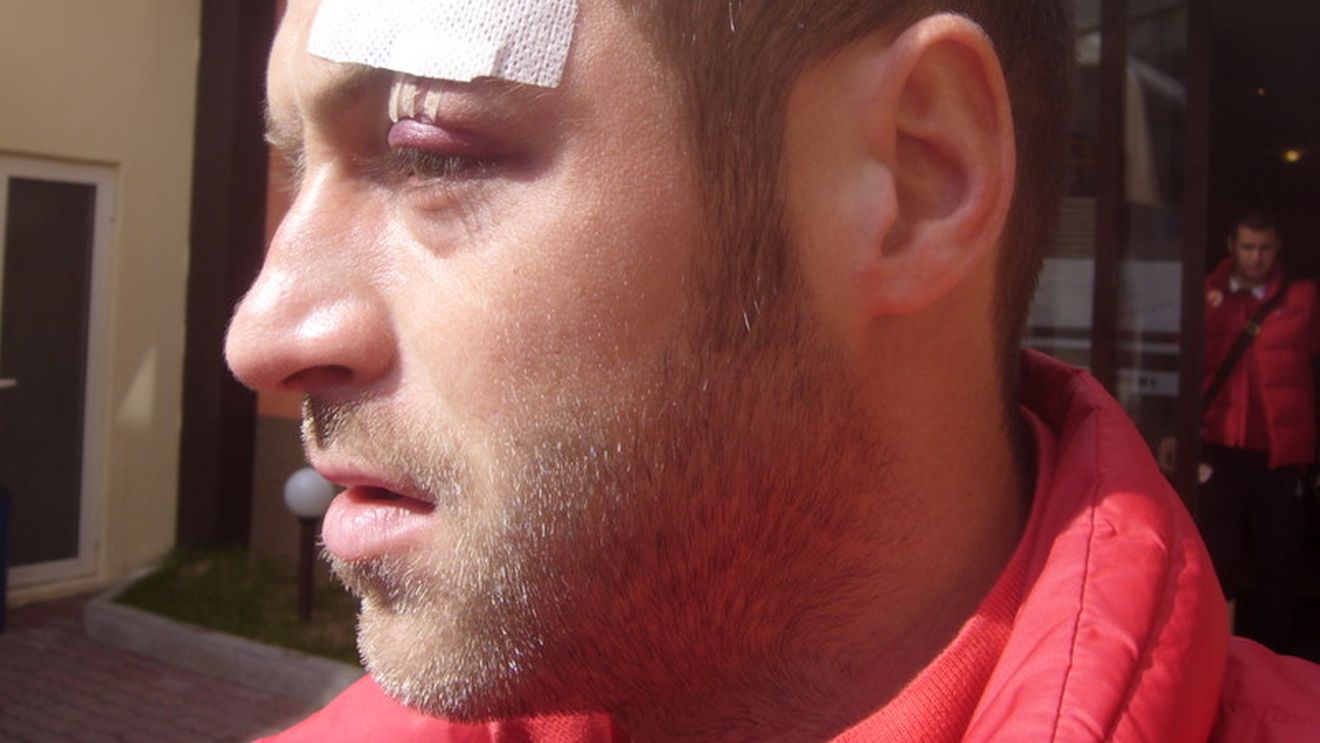 Prunea: "Pulhac are fața tumefiată, Cristea are o contuzie, dar nu avem timp de lamentări"